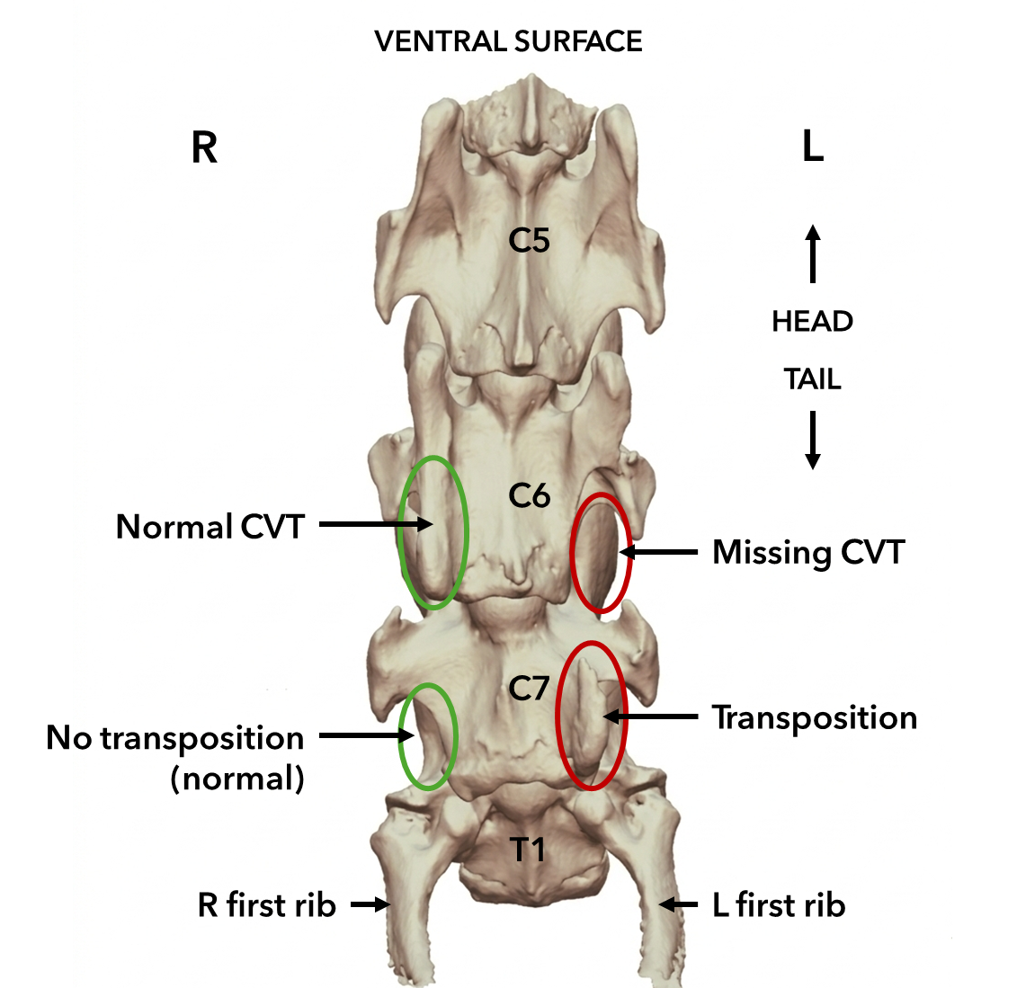 Anatomical diagram showing ECVM variations involving the C6 and C7 vertebrae and associated ribs in the horse